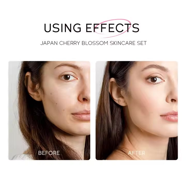 Hydrating Smooth Heal Dry Skin Moisturizing Reduce Fine Lines Brighten Skin Tone 5Pcs FENYI Sakura Skincare Facial Skin Care